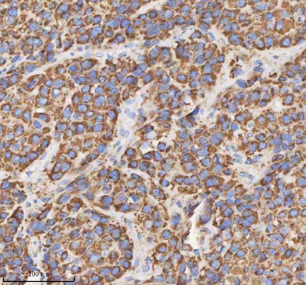 a03650 1 hadh primary antibodies ihc testing 7