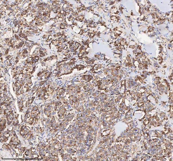 a03650 1 hadh primary antibodies ihc testing 8