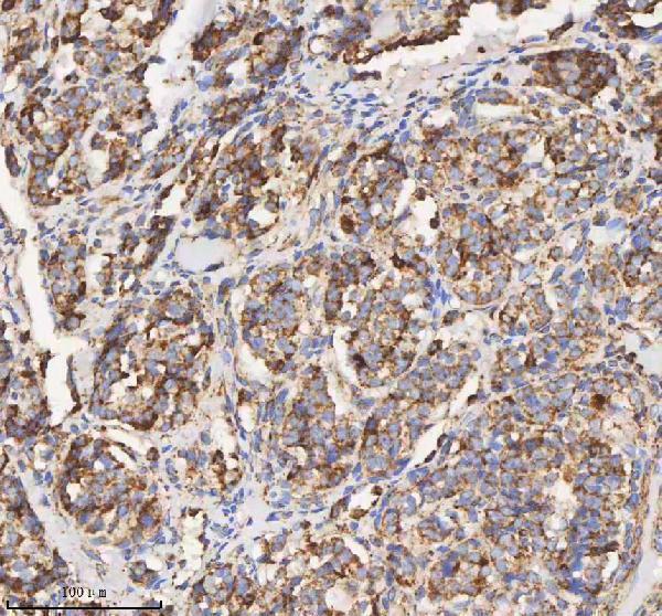 a03650 1 hadh primary antibodies ihc testing 9