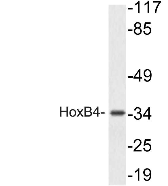 a03652 1 hoxb4 primary antibodies wb testing 1