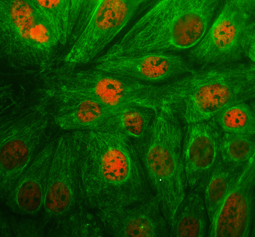 a03652 2 hoxb4 primary antibodies if testing 1