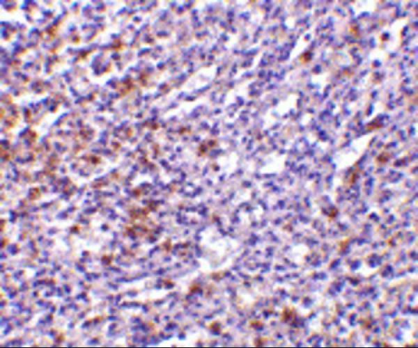 a03654 il27ra primary antibodies ihc testing 2