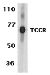 a03654 il27ra primary antibodies wb testing 1