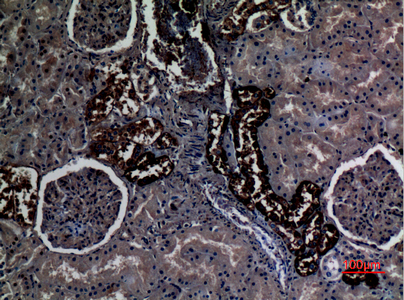 Immunohistochemical analysis of paraffin-embedded human-kidney, antibody was diluted at 1:100