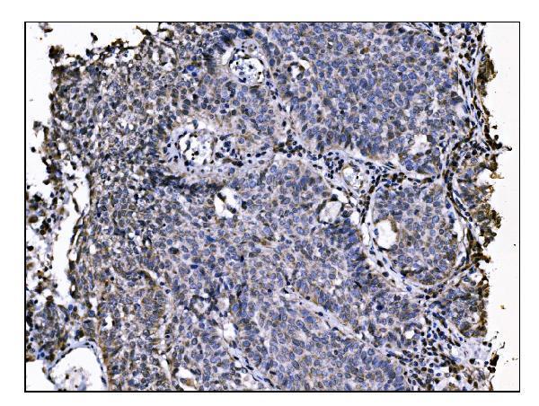 a03656 2 nde1 primary antibodies ihc testing 3