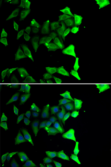 Immunofluorescence analysis of A549 cell using NDE1 antibody