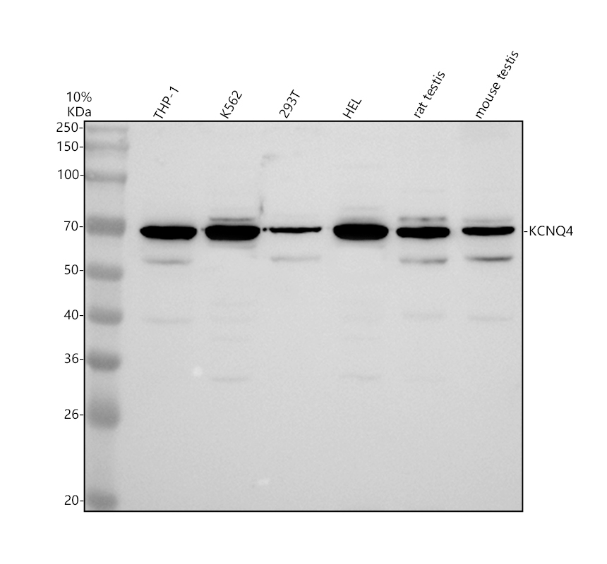 Western blot analysis of KCNQ4 using anti-KCNQ4 antibody (A03659-3)