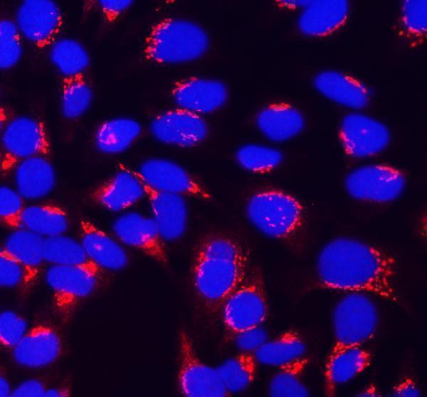 a03660 2 gopc primary antibodies if testing 1