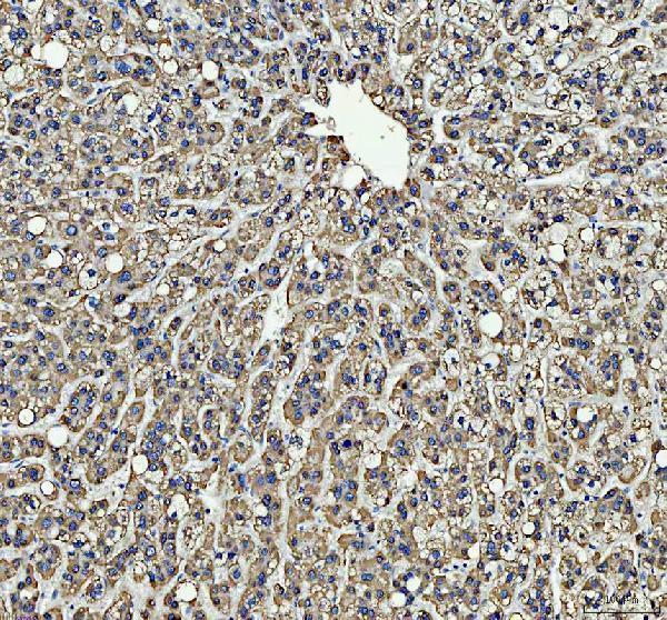 IHC analysis of PIST/GOPC using anti-PIST/GOPC antibody (A03660-2)