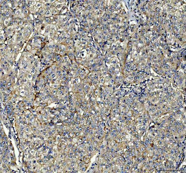 IHC analysis of PIST/GOPC using anti-PIST/GOPC antibody (A03660-2)