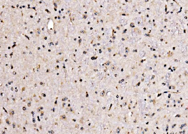 a03661 1 klf15 primary antibodies ihc testing 4