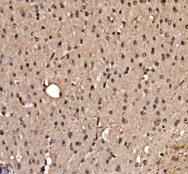 a03661 1 klf15 primary antibodies ihc testing 5