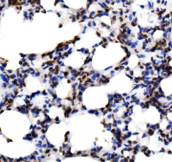 a03661 1 klf15 primary antibodies ihc testing 6