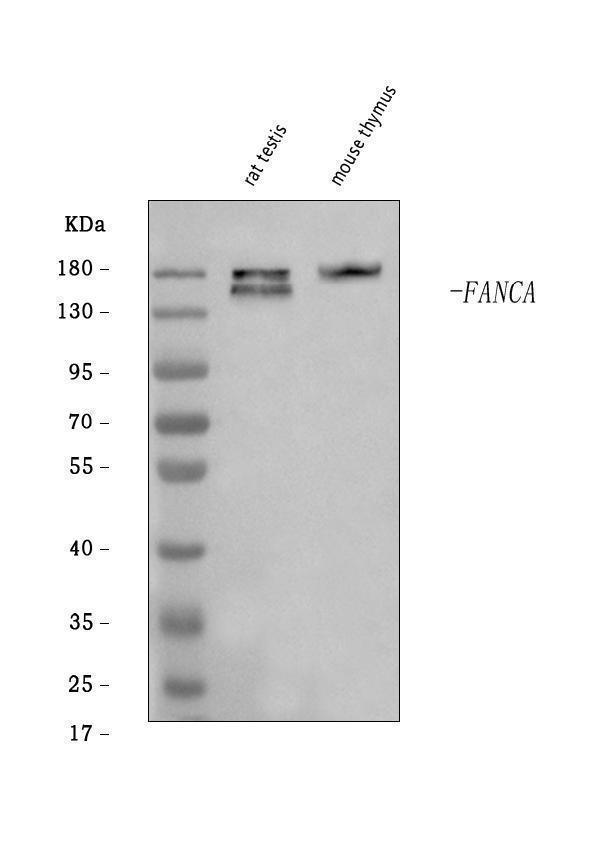  Western blot analysis of Fanca/FAA using anti-Fanca/FAA antibody (A03662-2)