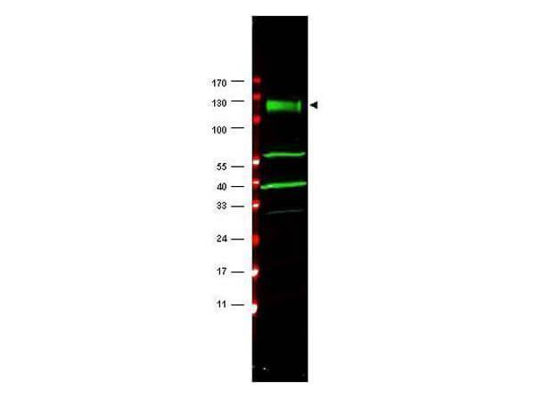 Western blot using Boster's affinity purified anti-FANCA antibody shows detection of a band at ~133 kDa (arrowhead) corresponding to FANCA in HeLa whole cell lysates 