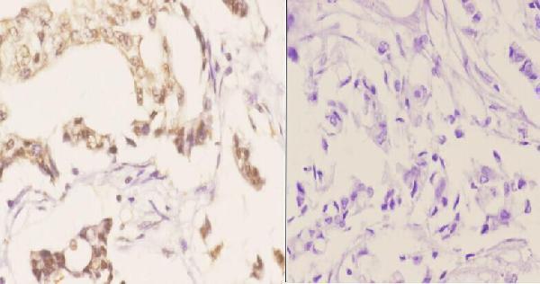 a03662s1149 fanca primary antiboties ihc testing 2