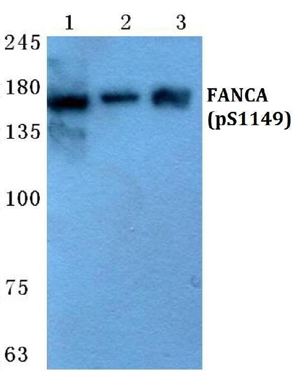 a03662s1149 fanca primary antiboties wb testing 1