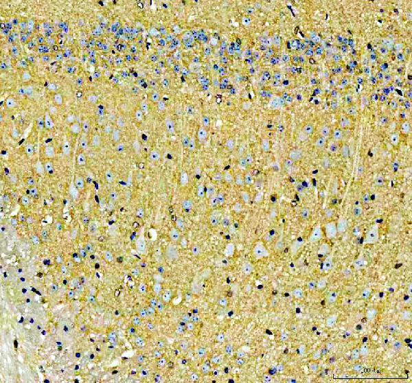 IHC analysis of SLC17A7 using anti-SLC17A7 antibody (A03664-1)