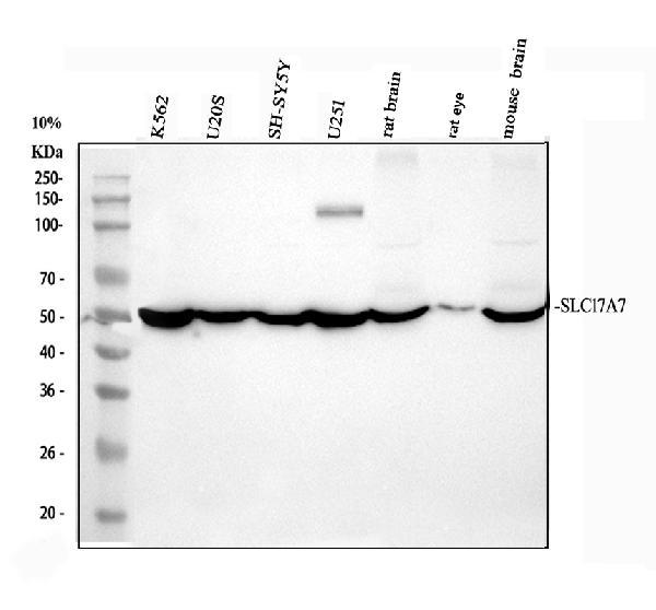 Western blot analysis of SLC17A7 using anti-SLC17A7 antibody (A03664-1)