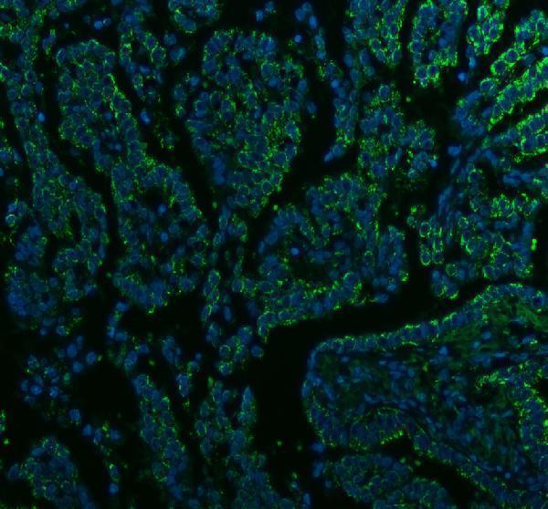 a03666 2 hadha primary antibodies if testing 1