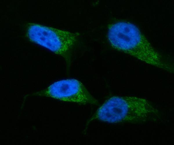 a03666 2 hadha primary antibodies if testing 17