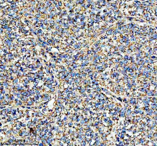 a03666 2 hadha primary antibodies ihc testing 10