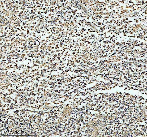 a03666 2 hadha primary antibodies ihc testing 13