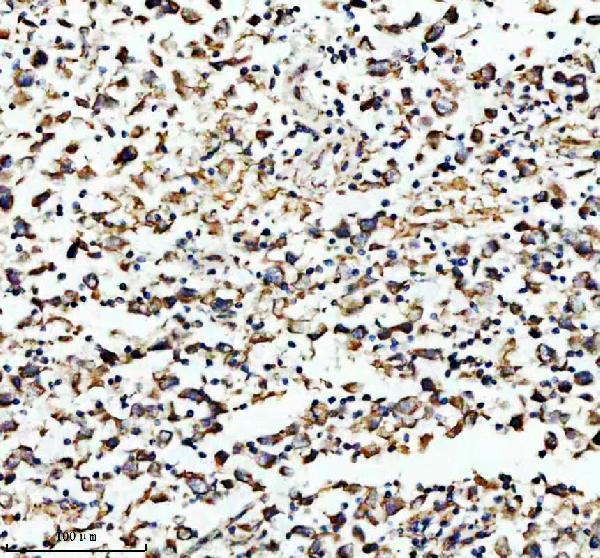 a03666 2 hadha primary antibodies ihc testing 14