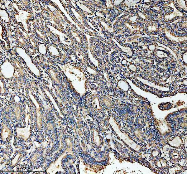 a03666 2 hadha primary antibodies ihc testing 15