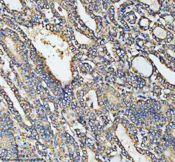 a03666 2 hadha primary antibodies ihc testing 16