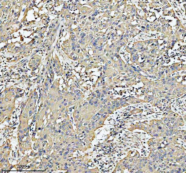  IHC analysis of HADHA using anti-HADHA antibody (A03666-2)