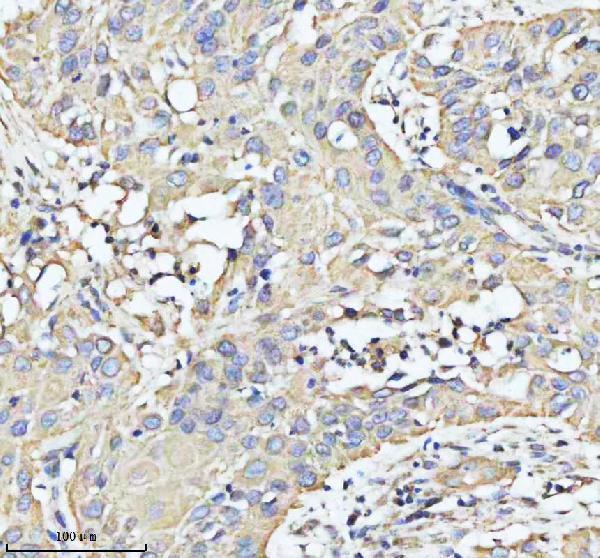a03666 2 hadha primary antibodies ihc testing 4