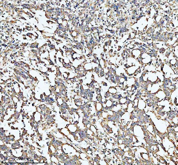 a03666 2 hadha primary antibodies ihc testing 5
