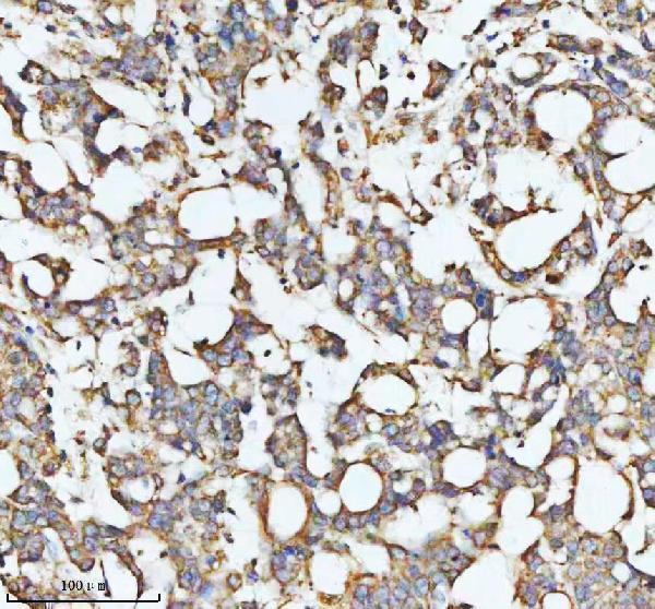 a03666 2 hadha primary antibodies ihc testing 6