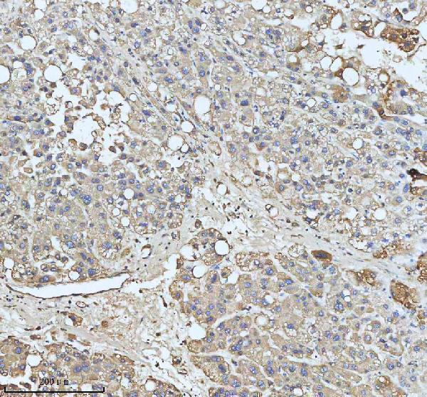 a03666 2 hadha primary antibodies ihc testing 7
