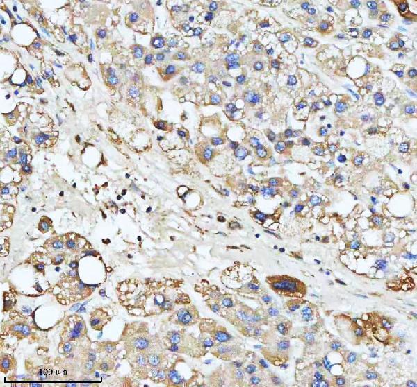 a03666 2 hadha primary antibodies ihc testing 8