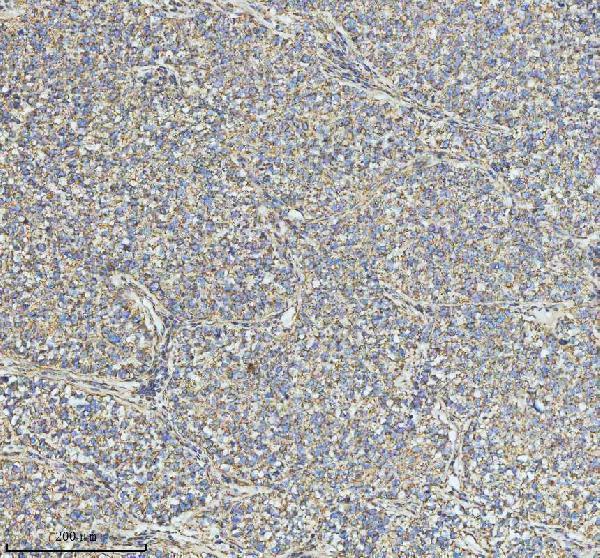 a03666 2 hadha primary antibodies ihc testing 9