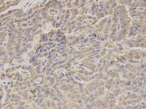 a03666 hadha primary antiboties wb testing 2