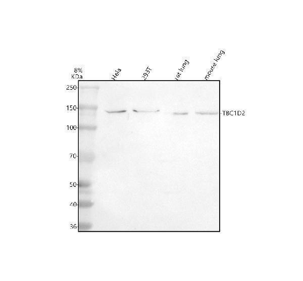 Western blot analysis of TBC1D1 using anti-TBC1D1 antibody (A03667-1)