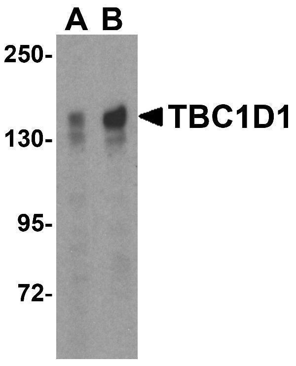 Western blot analysis of TBC1D1 expression in (A) 293 and (B) Daudi cell lysate with TBC1D1 antibody at 2 μg/ml