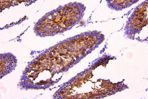 a03668 2 acacb primary antibodies ihc testing 2_1