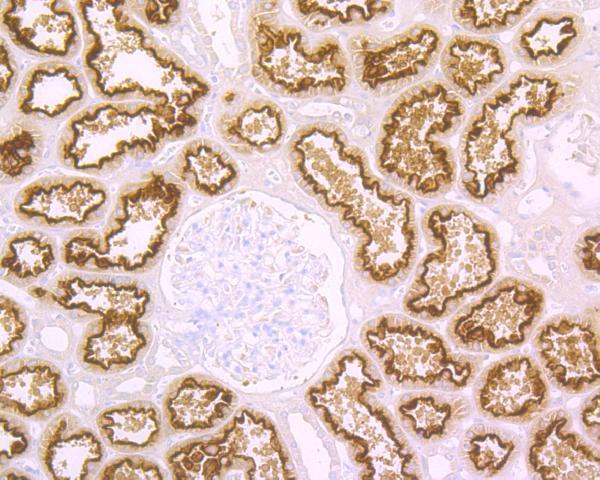 Immunohistochemical analysis of paraffin-embedded human kidney tissue using anti-Cubilin antibody