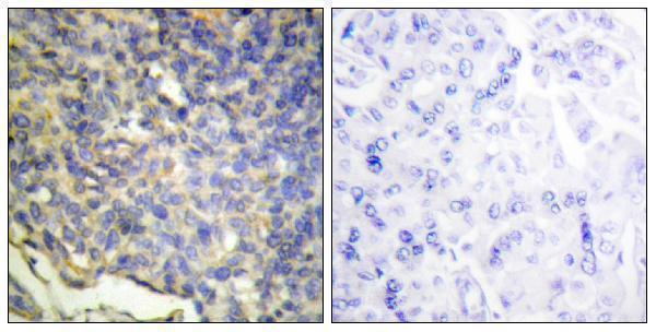 a03671 1 dffa primary antibodies ihc testing 1