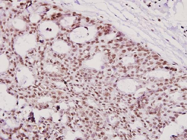 a03671 3 dffa primary antiboties ihc testing 2