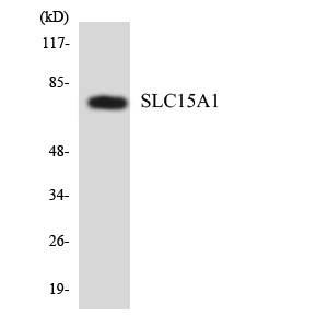 Western blot analysis of the lysates from HeLa cells using SLC15A1 antibody