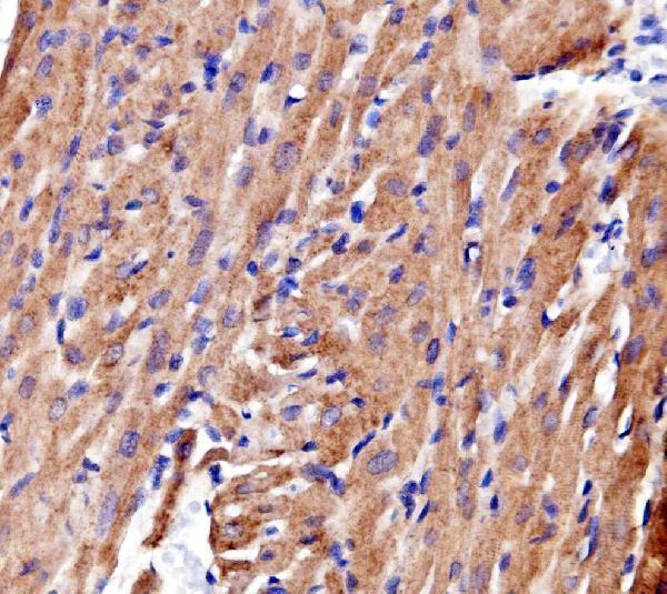 a03673 1 actn2 primary antibodies ihc testing 3