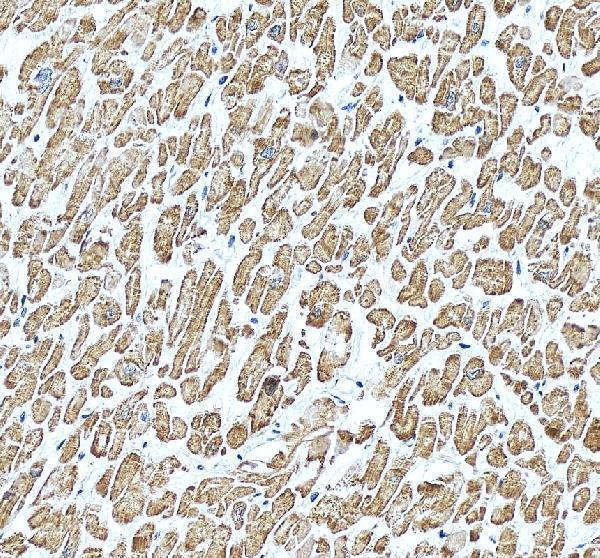 IHC analysis of Alpha Actinin/ACTN2 using anti-Alpha Actinin/ACTN2 antibody (A03673-1)