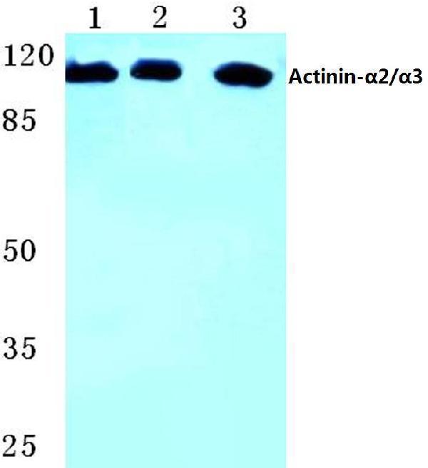 Western blot (WB) analysis of Actinin-α2/3 (Q58) polyclonal antibody at 1:500 dilution
Lane1:Hela cell lysate
Lane2:Mouse kidney tissue lysate
Lane3:H9C2 cell lysate