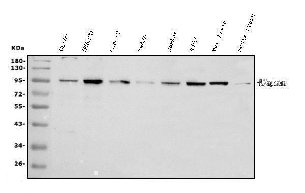  Western blot analysis of Plasminogen using anti-Plasminogen antibody (A03674-1)