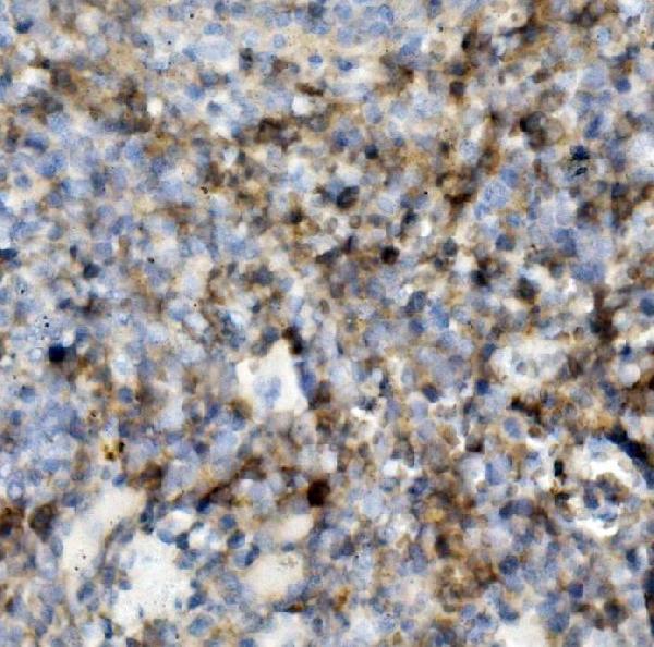  IHC analysis of SELPLG using anti-SELPLG antibody (A03674-3)